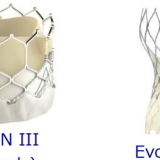 保護中： TAVI 初級編　１　TAVI（サピエン３）の簡単な流れ