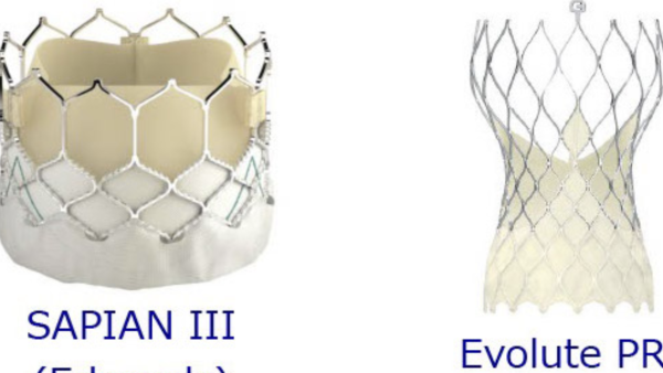 保護中： TAVI 初級編　１　TAVI（サピエン３）の簡単な流れ